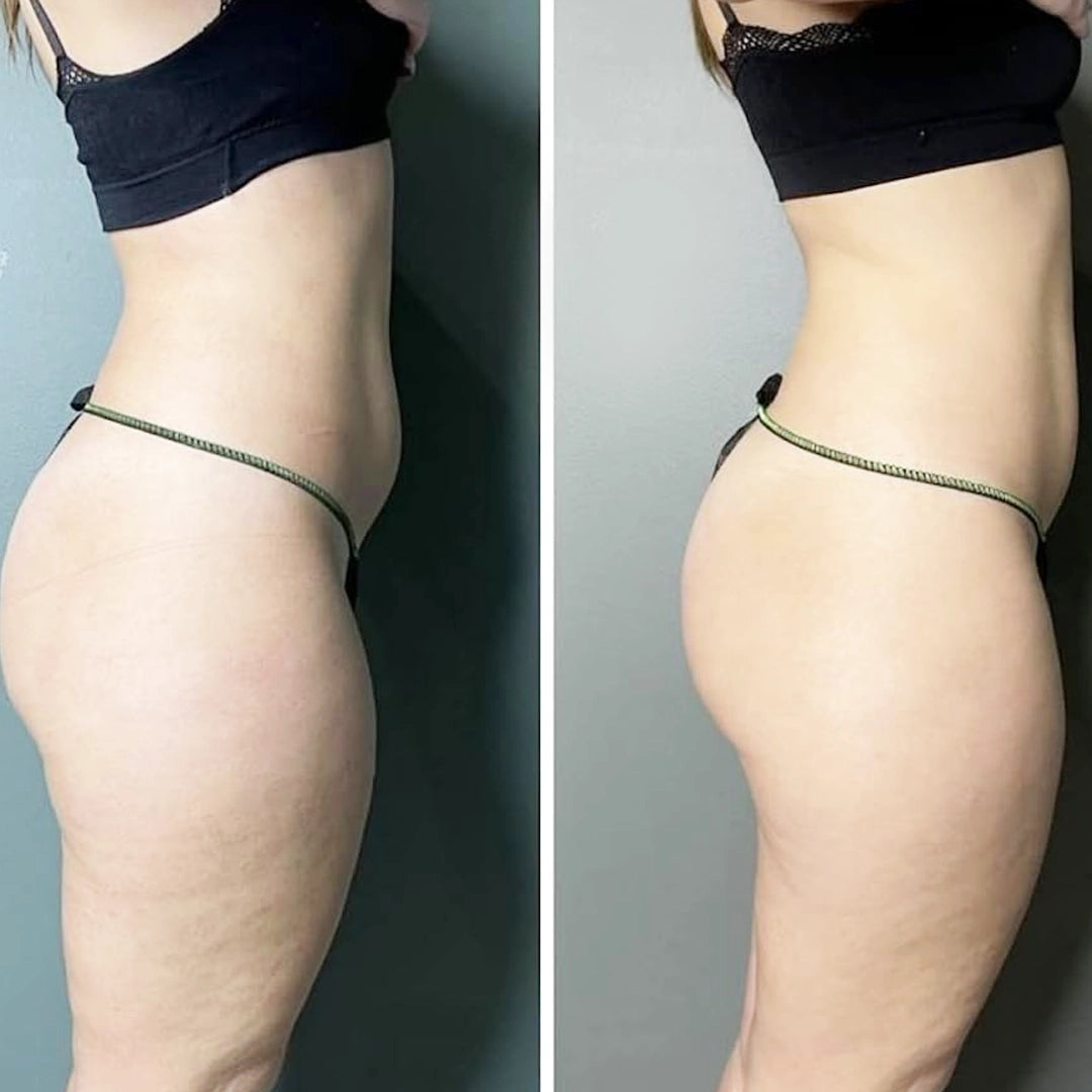 Peel-Off BODY MASK Kit