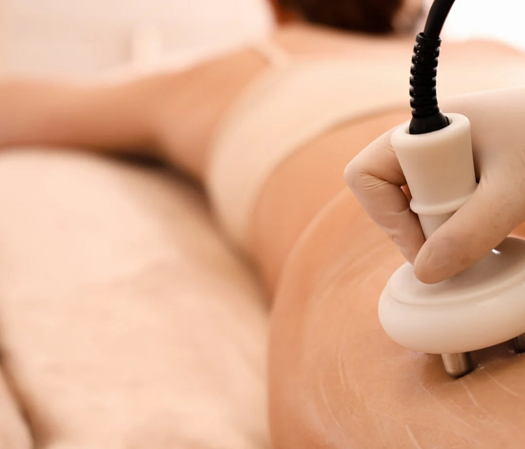 Electroporación – Mesoterapia Virtual