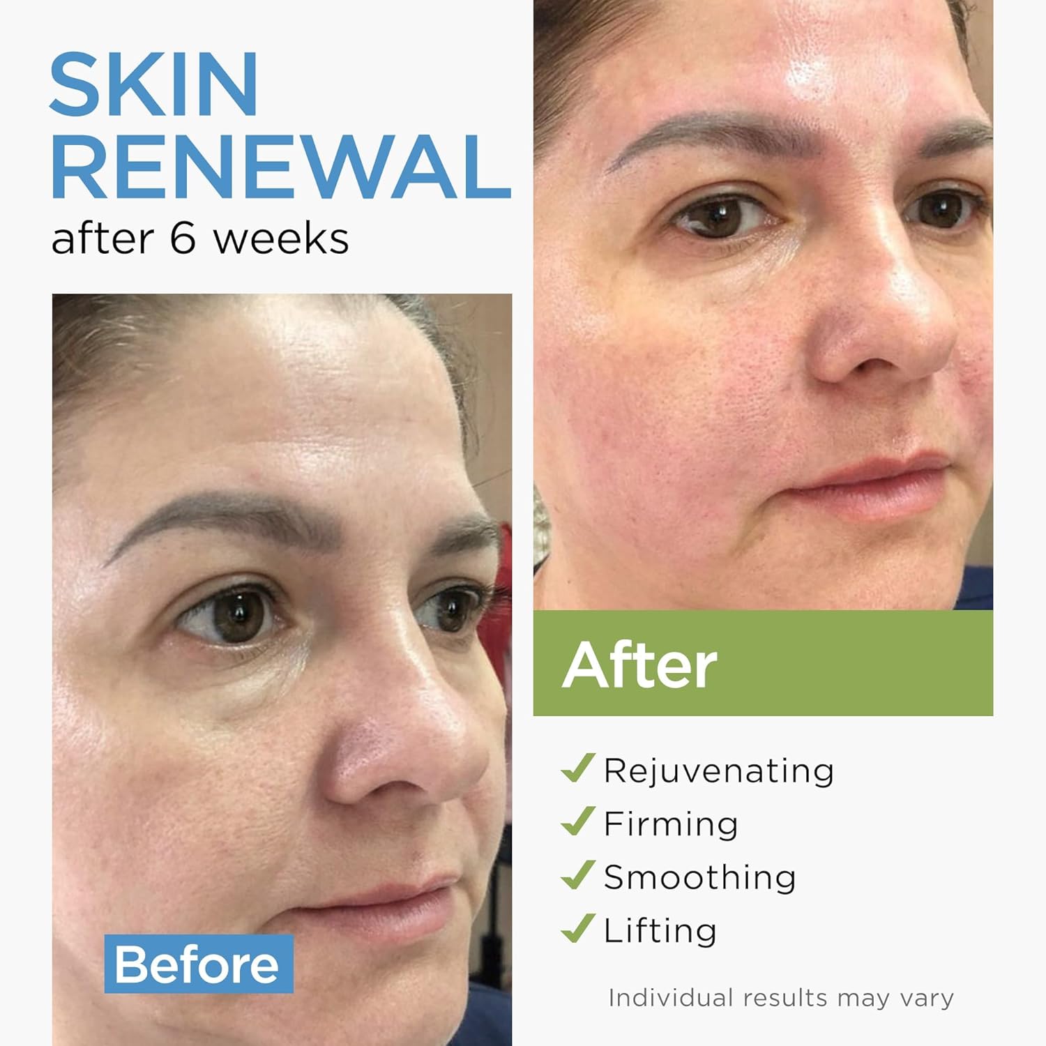 Crema hidratante antienvejecimiento con colágeno, 4 oz