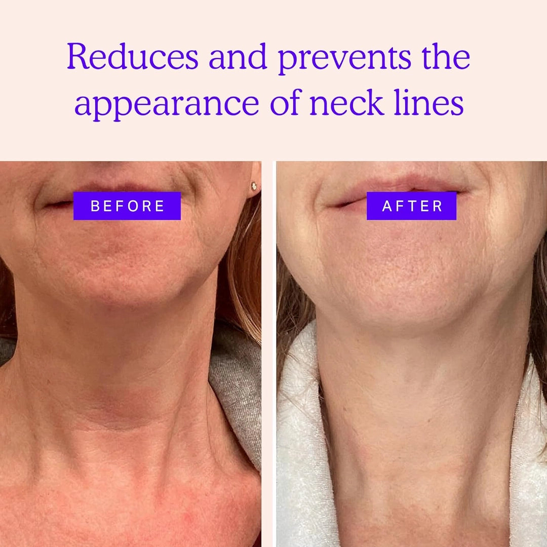 Neck Patch w/ Ginseng, Collagen & Elastin
