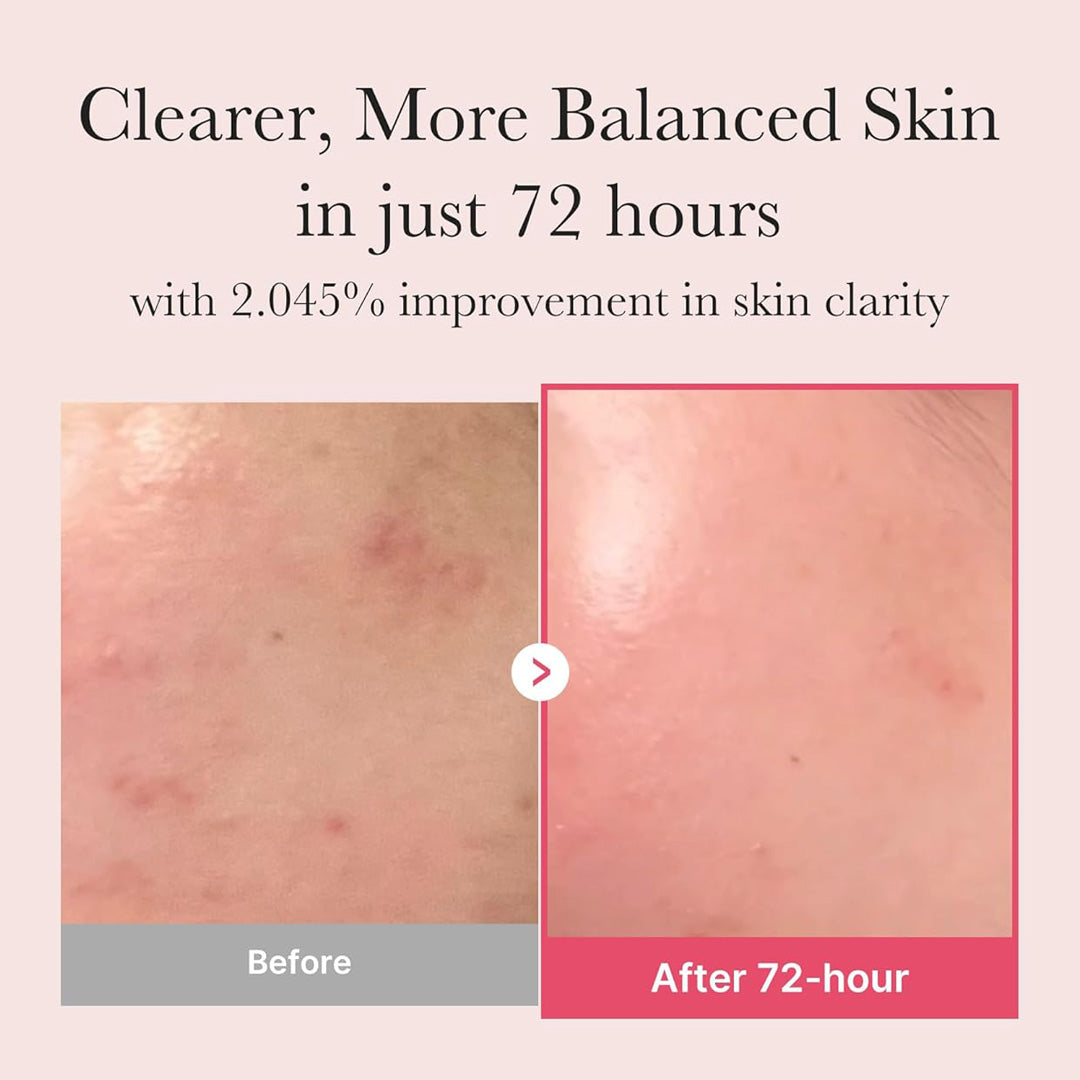 Niacinamide Facial Serum 30 ml.
