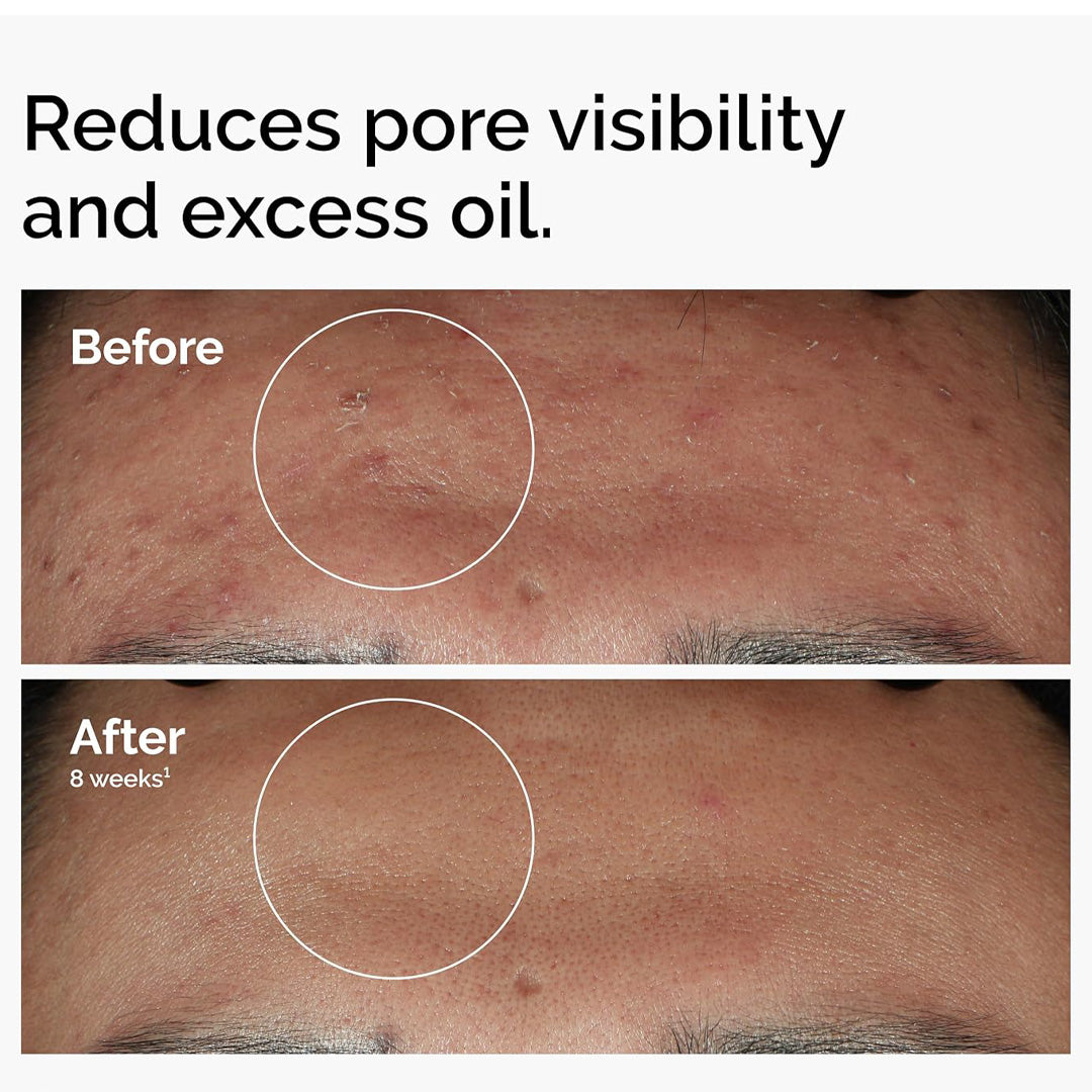 Niacinamide Facial Serum 30 ml.