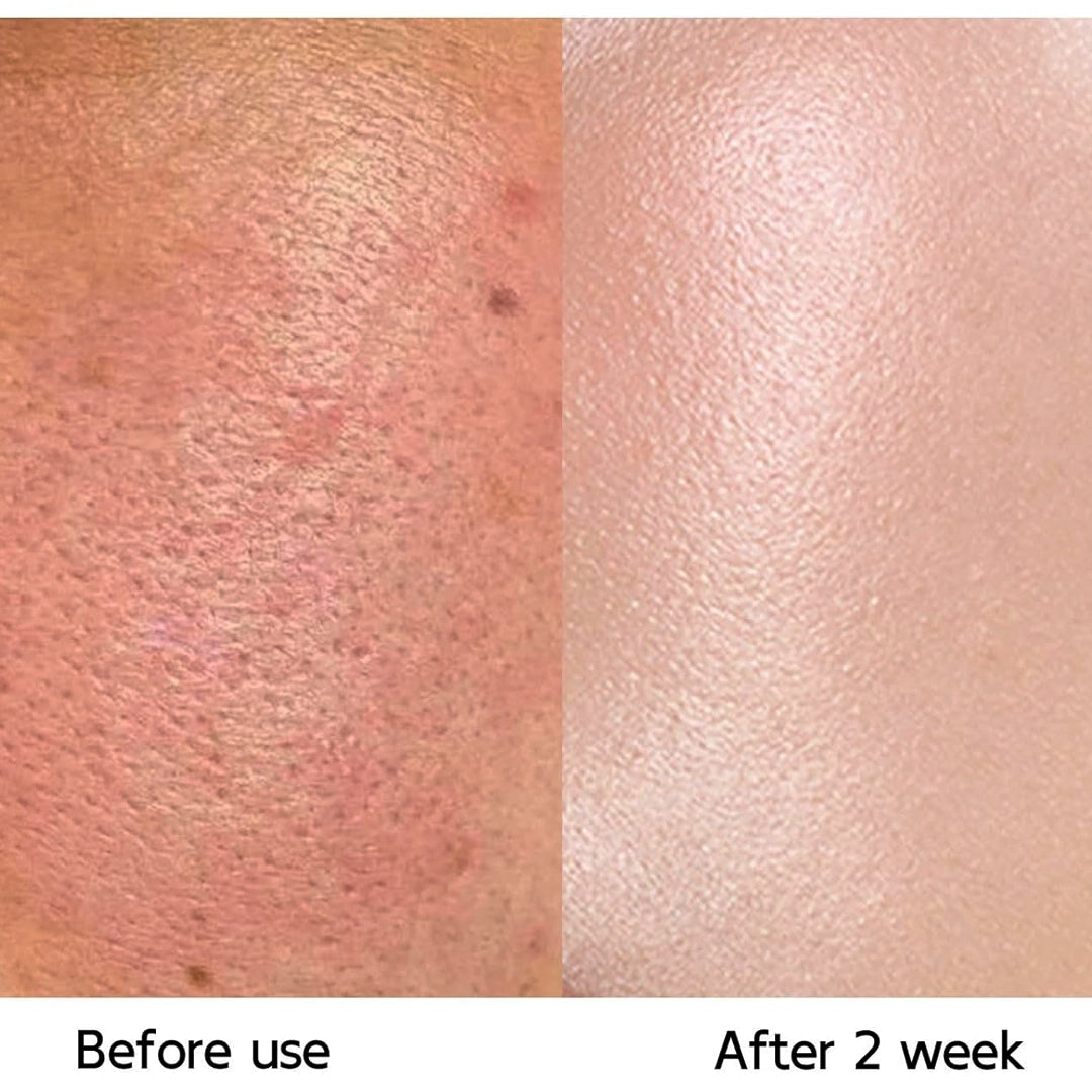 Salmon DNA Serum 30 ml.