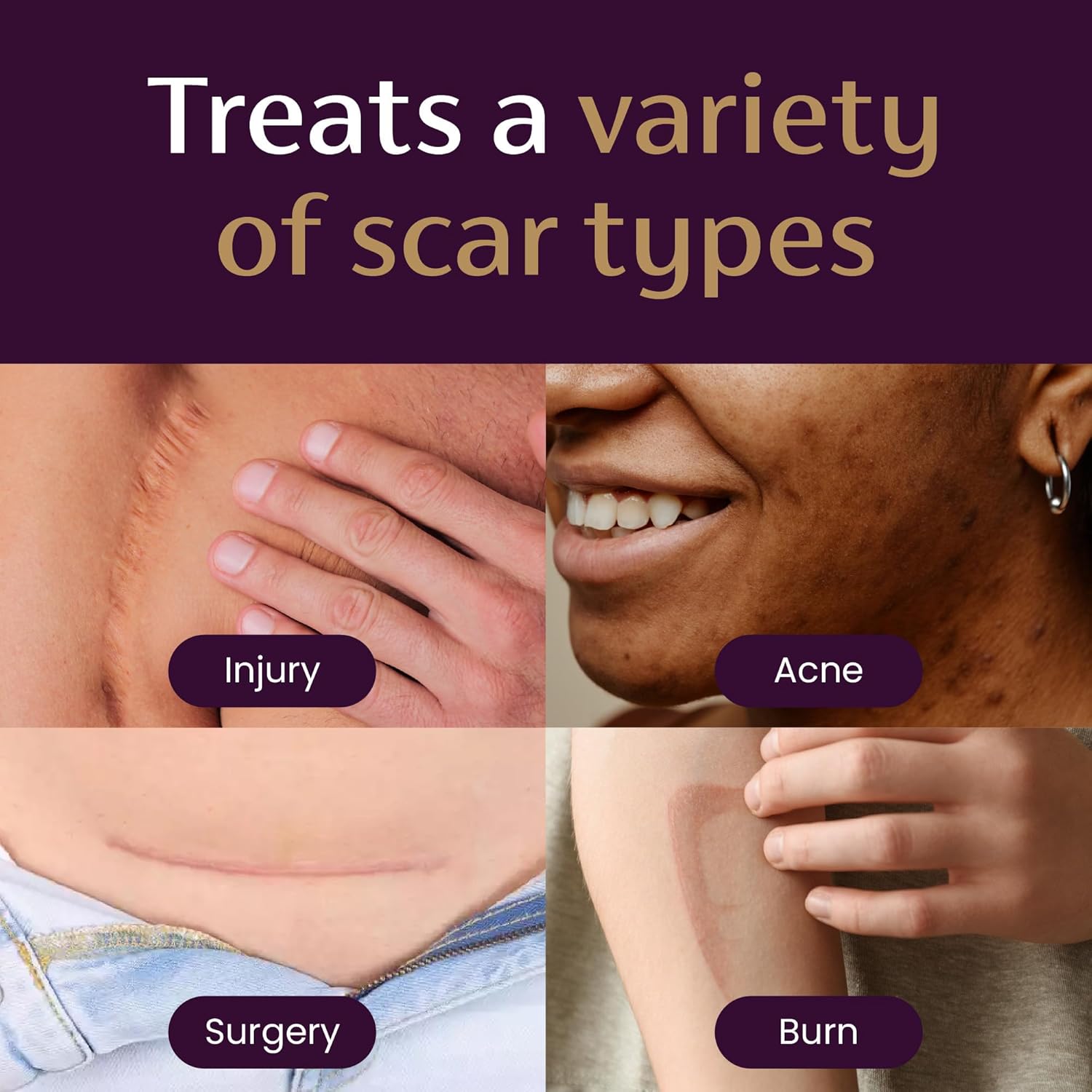 ScarFade – Advanced Scar & Skin Repair Serum 8 oz.