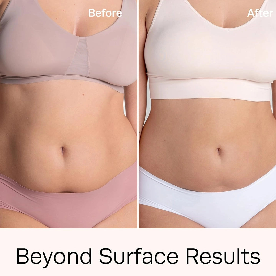 Cryo-Slim Cold Gel 64 oz - Professional Cryotherapy for Body Contouring & Firming