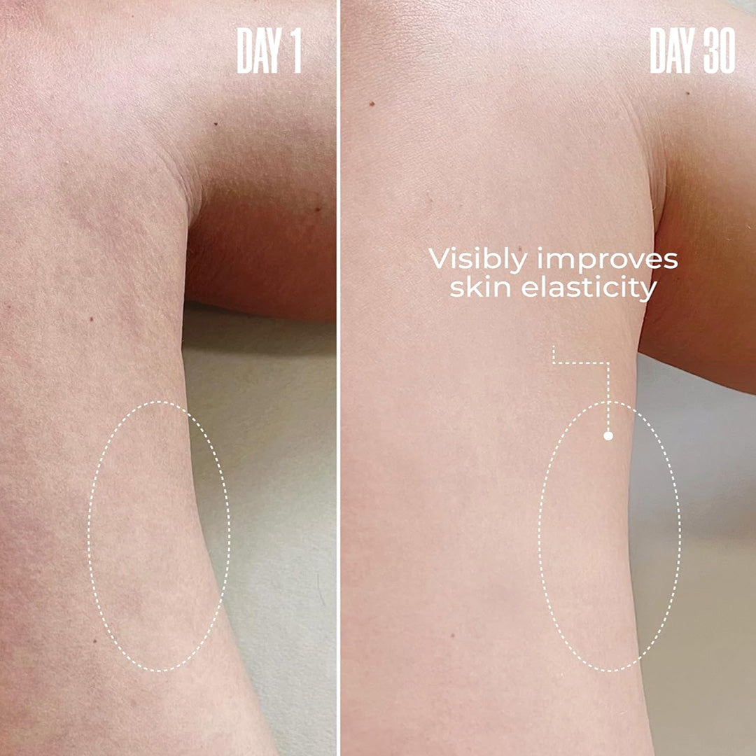 ThighTight™ – Crema reafirmante para la parte interna de los muslos, 8 oz.