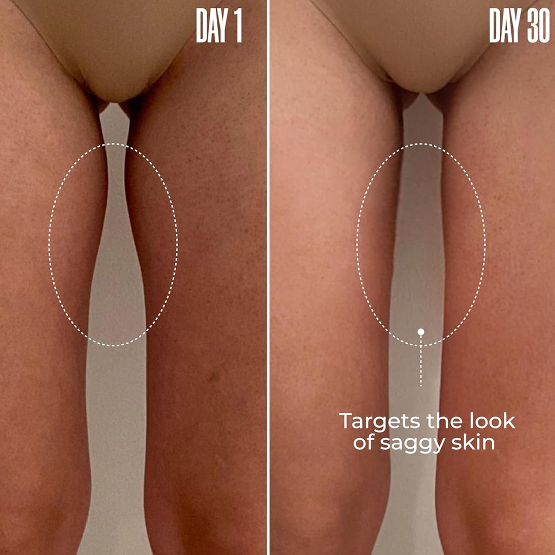 ThighTight™ – Crema reafirmante para la parte interna de los muslos, 8 oz.
