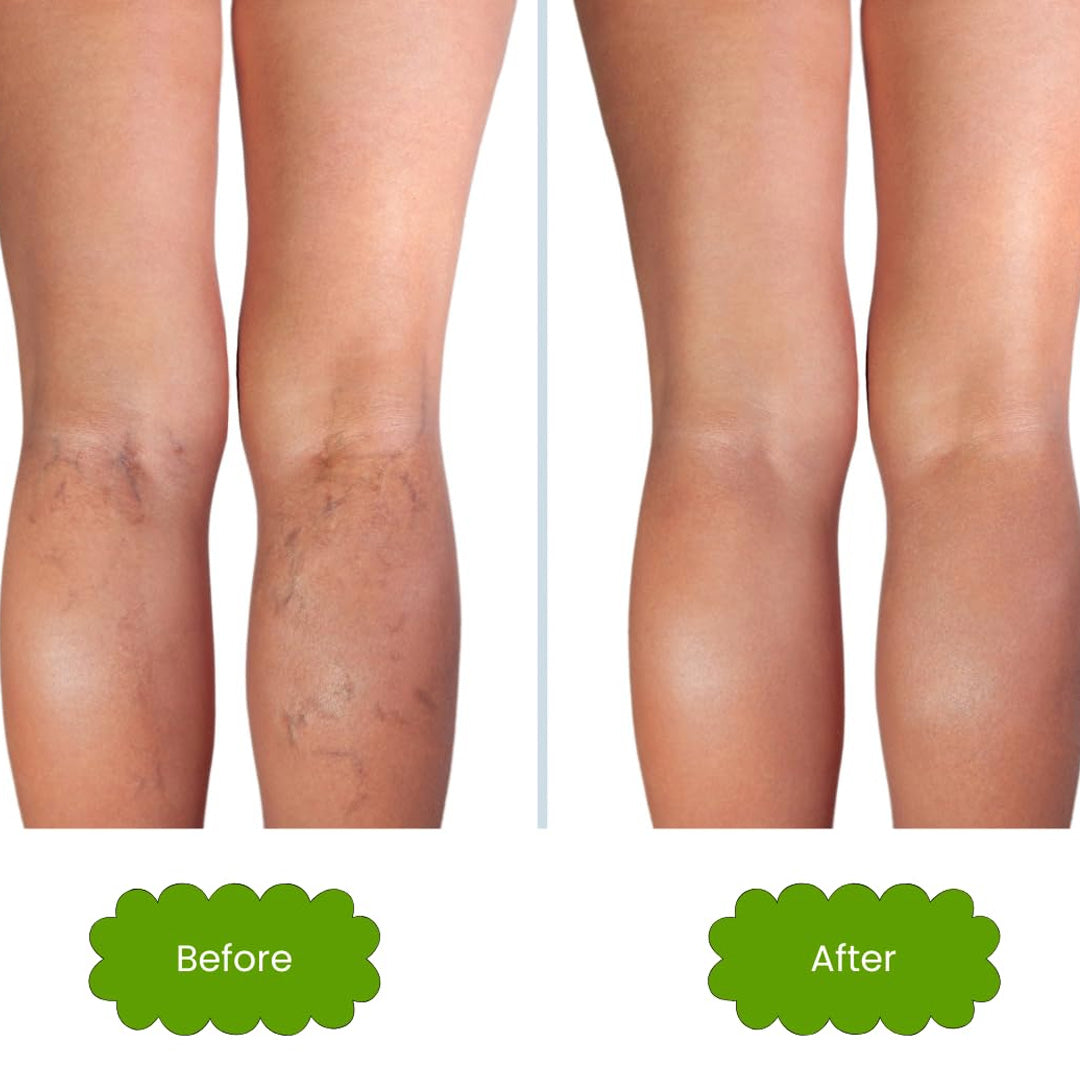 VariSolution Serum 8 oz.