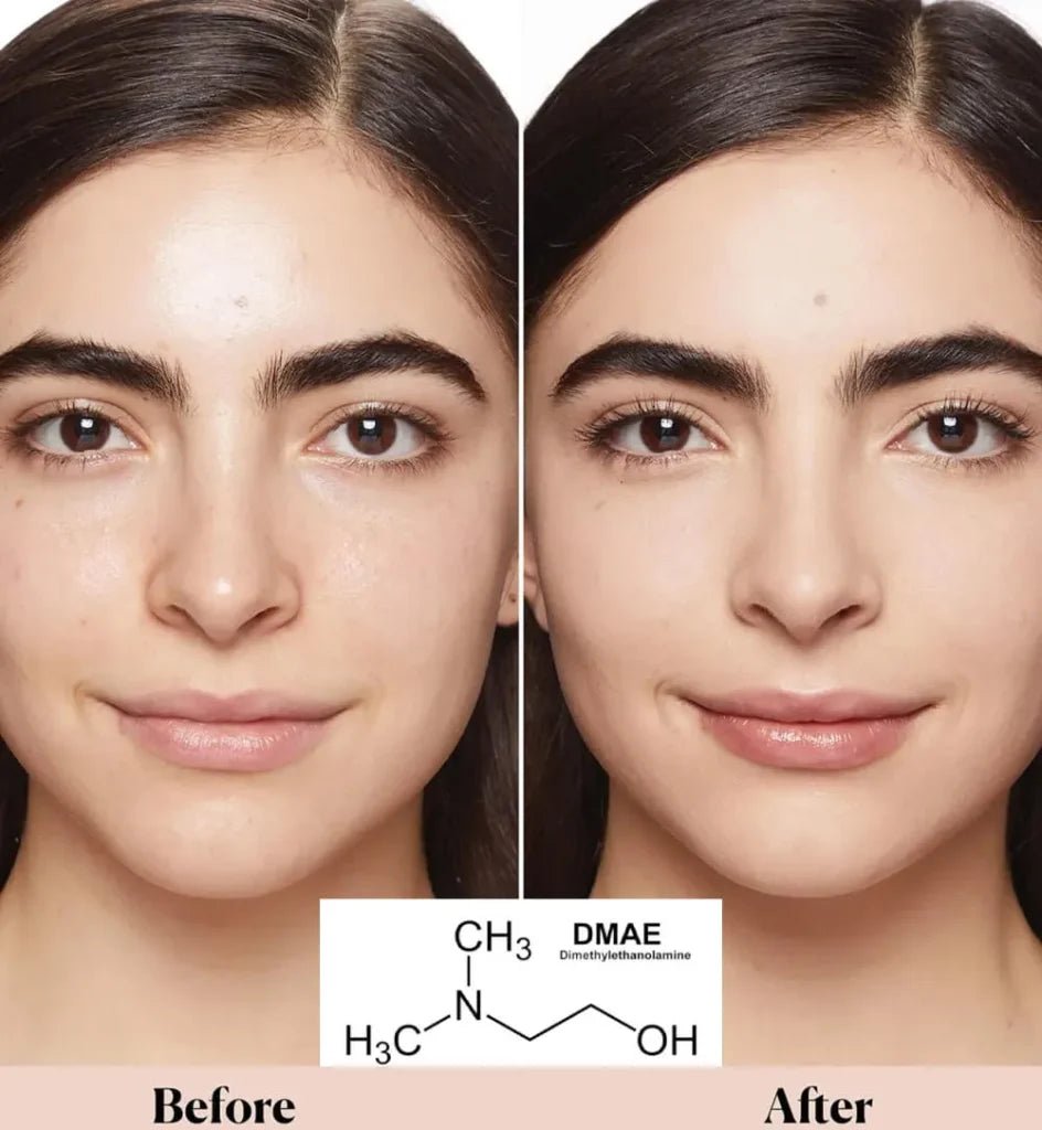 Antiaging D.M.A.E (5 Vials x 10 ml ea) - SlimSpaOnline