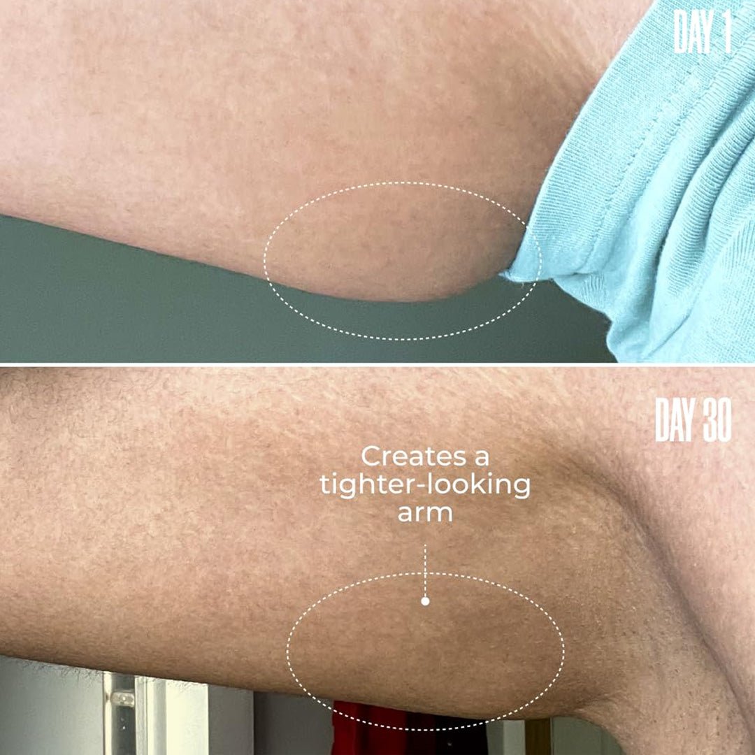 ArmTight™ Saggy Arm Firming Cream 8 oz. - SlimSpaOnline