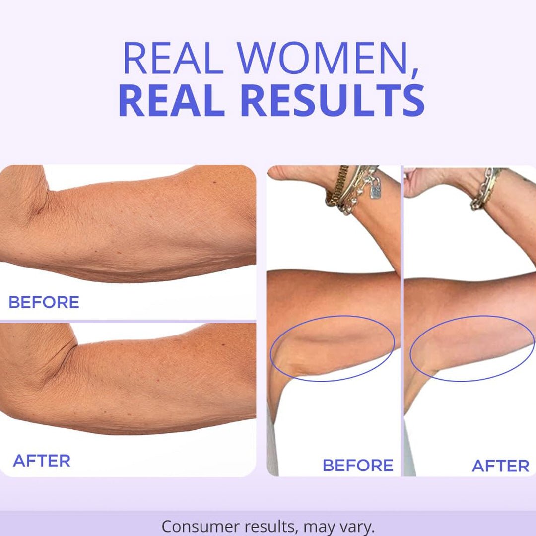 ArmTight™ Saggy Arm Firming Cream 8 oz. - SlimSpaOnline
