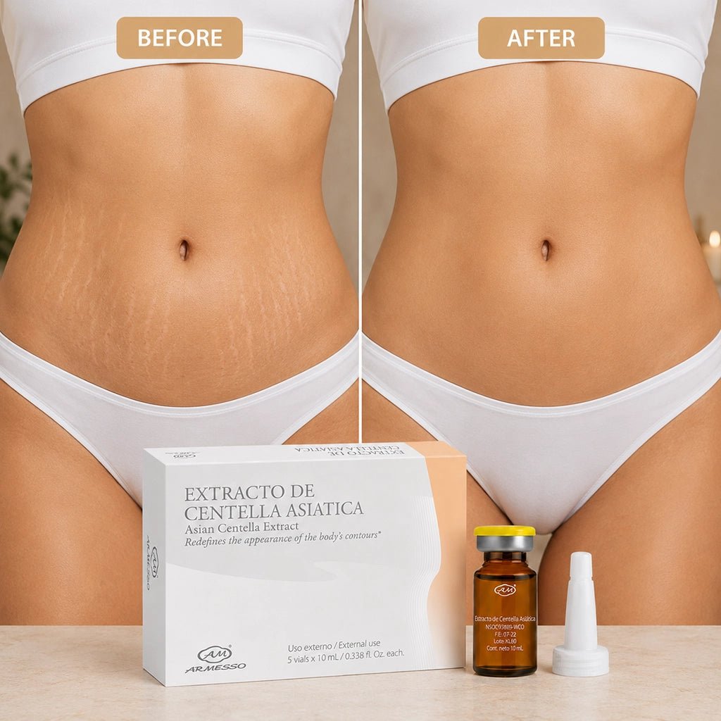 Asian Centella Vials – Professional Skin Firming, Stretch Mark & Scar Repair Mesotherapy (5x10ml) - SlimSpaOnline