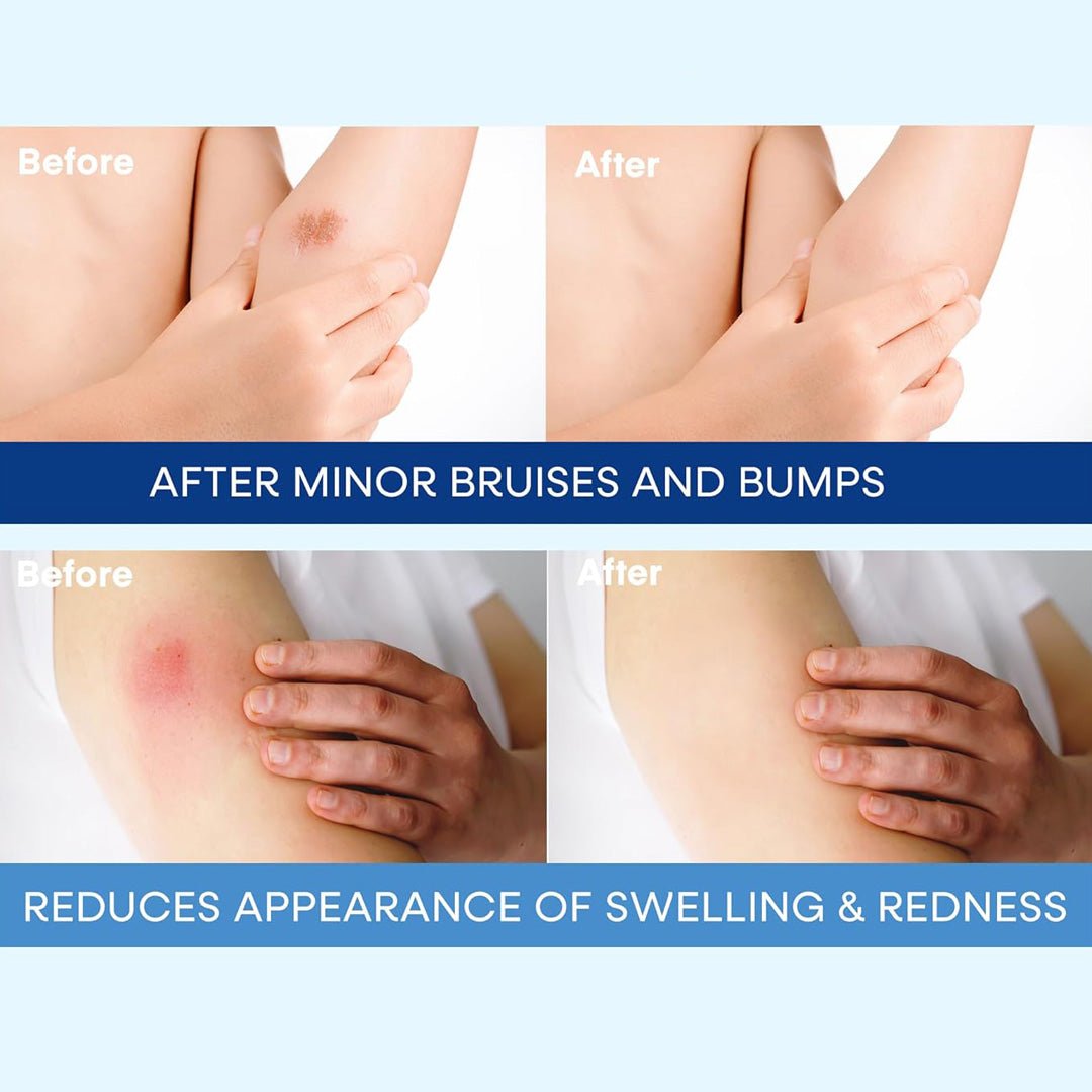 Bruise & Scar Organic Cream 8 oz - SlimSpaOnline