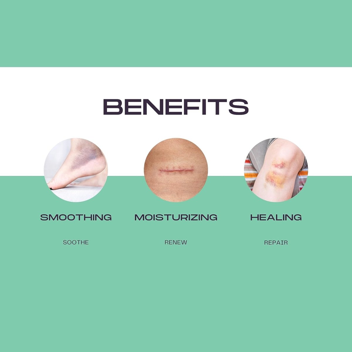 Bruise & Scar Organic Cream 8 oz - SlimSpaOnline