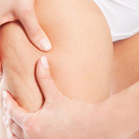 CelluSolution Natural Herbal Anti - Cellulite Formula 60 Caps - SlimSpaOnline