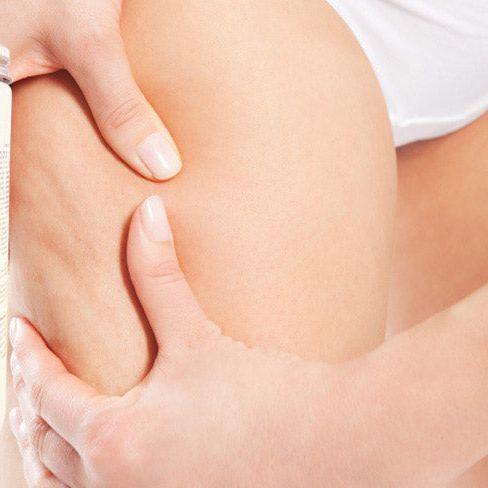 CelluSolution Pro Anti - Cellulite Gel 32oz - SlimSpaOnline