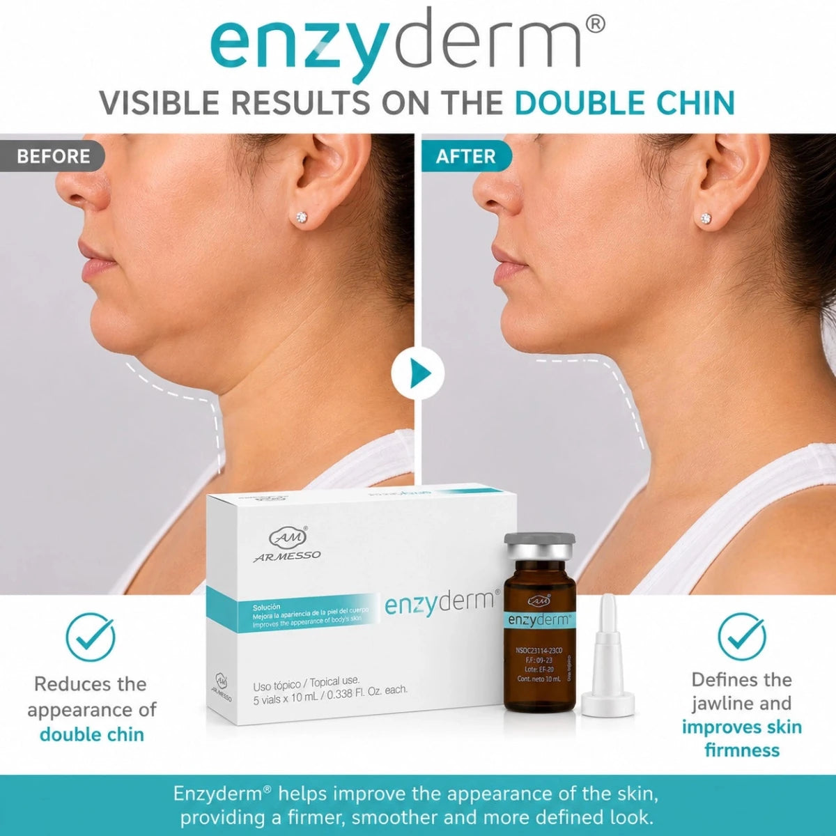 EnzyDerm Enzymatic Adipolipolysis Vials – Professional Non-Invasive Double Chin, Cellulite & Fibrosis Treatment (Lipase + Exosomes, 5x10ml) - SlimSpaOnline