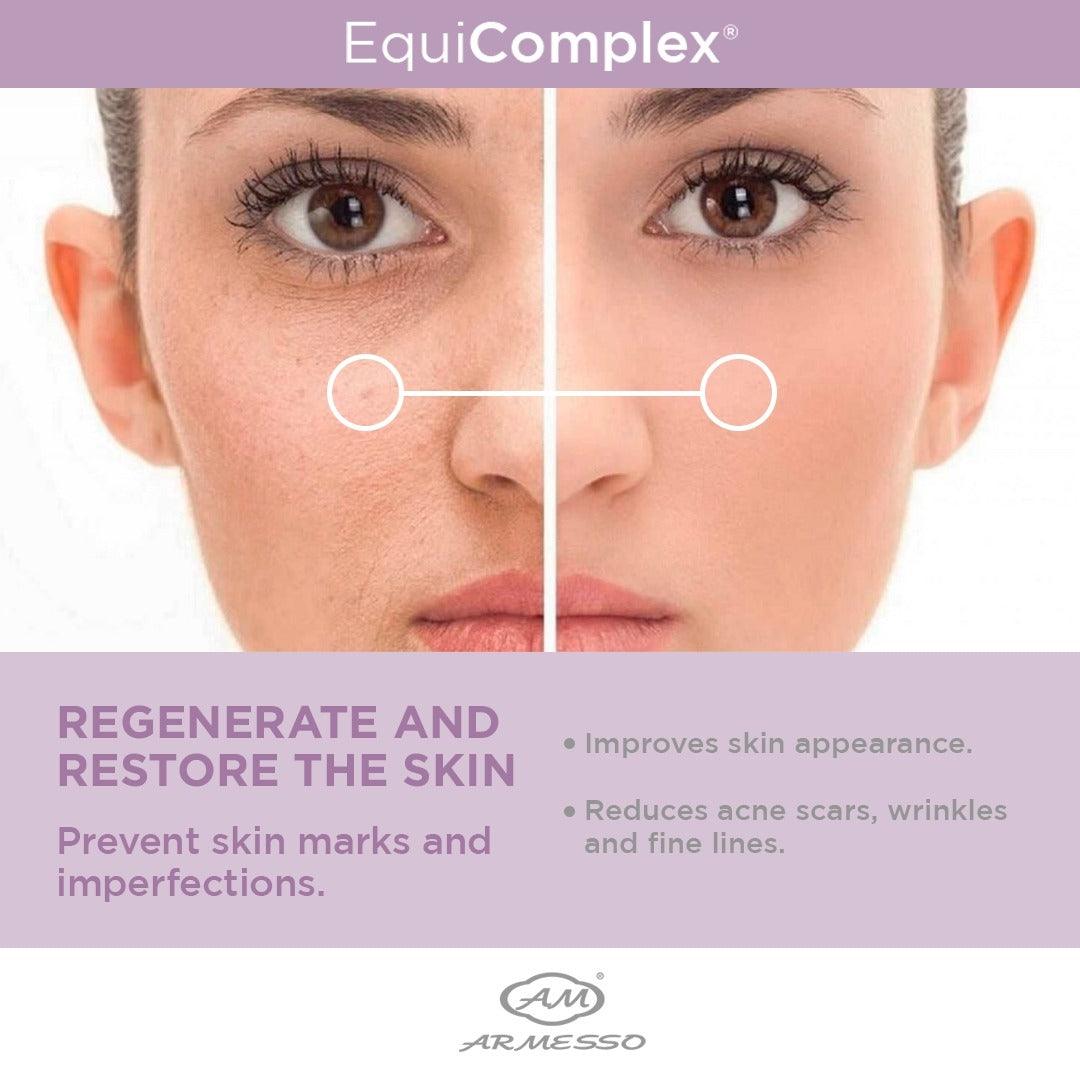 EQUICOMPLEX (10 ampoules x 2 ml ea.) - SlimSpaOnline