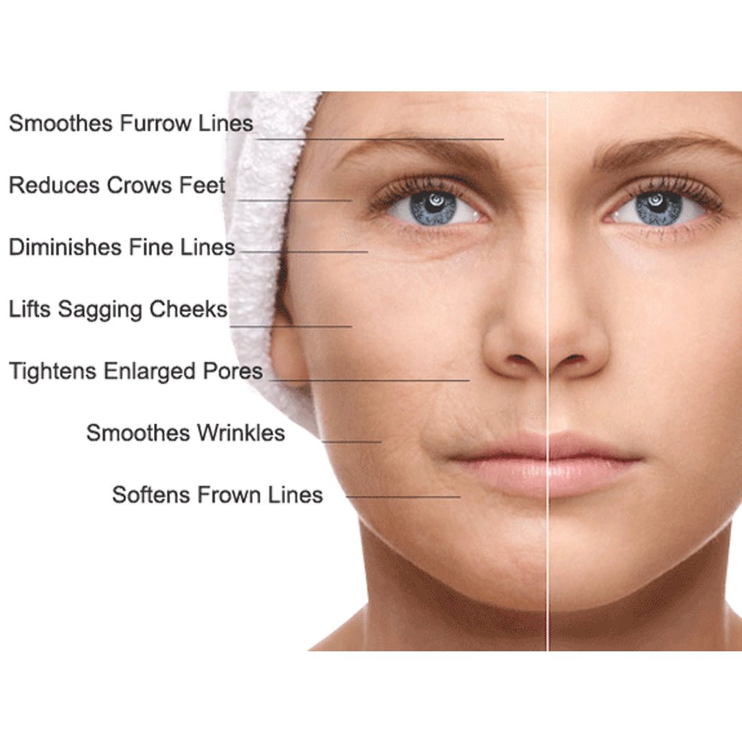 Facial BioRejuvenation Protocol (5 Vials x 10 ml) 50 ml - SlimSpaOnline