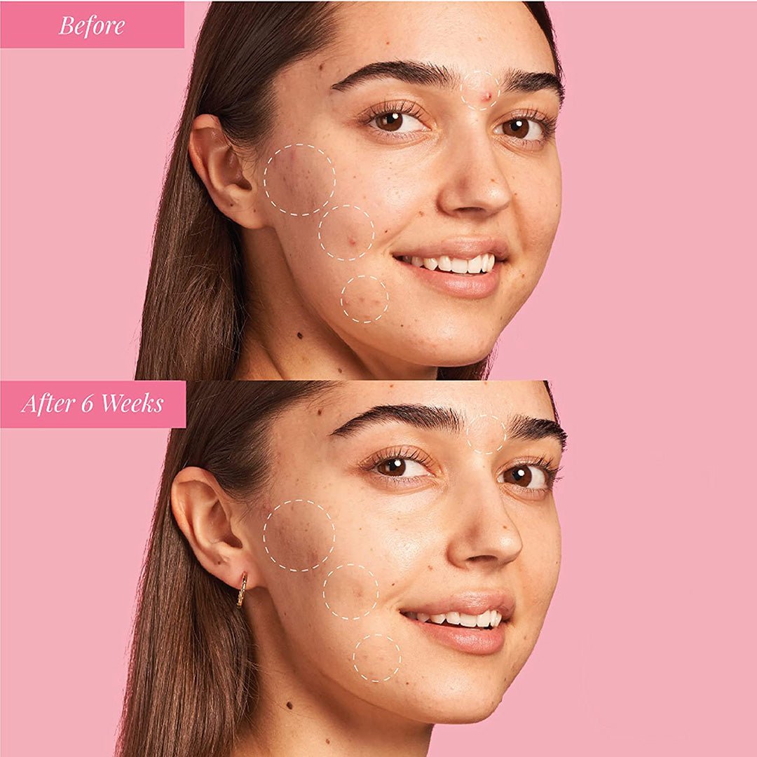 Glow & Protect Duo (Niacinamide + Ceramide) 2 x 30 ml. - SlimSpaOnline