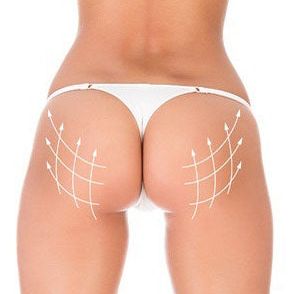 GLUTEOX Non-Invasive Butt Enhancement Vials - Professional Mesotherapy for Spas | SlimSpa