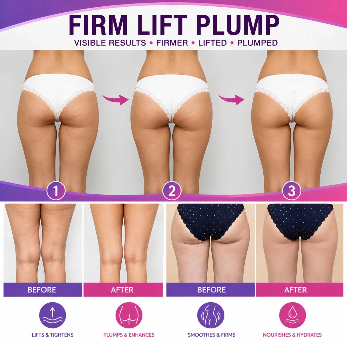 Gluteus Solution Cream – Professional Buttocks Lifting, Firming & Anti-Cellulite Treatment (8 oz) - SlimSpaOnline