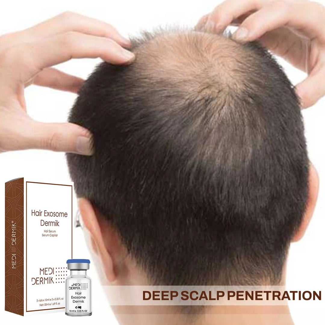 Exosoma capilar Dermik (5 viales x 10 ml) (50 ml) 