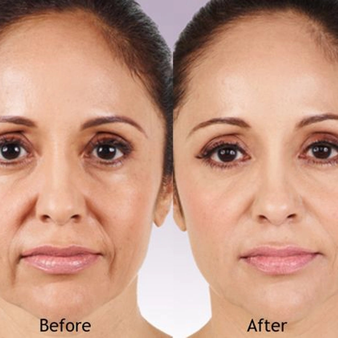 Hyaluronic Acid + Vitamin C 20% Plus SERUM 2oz