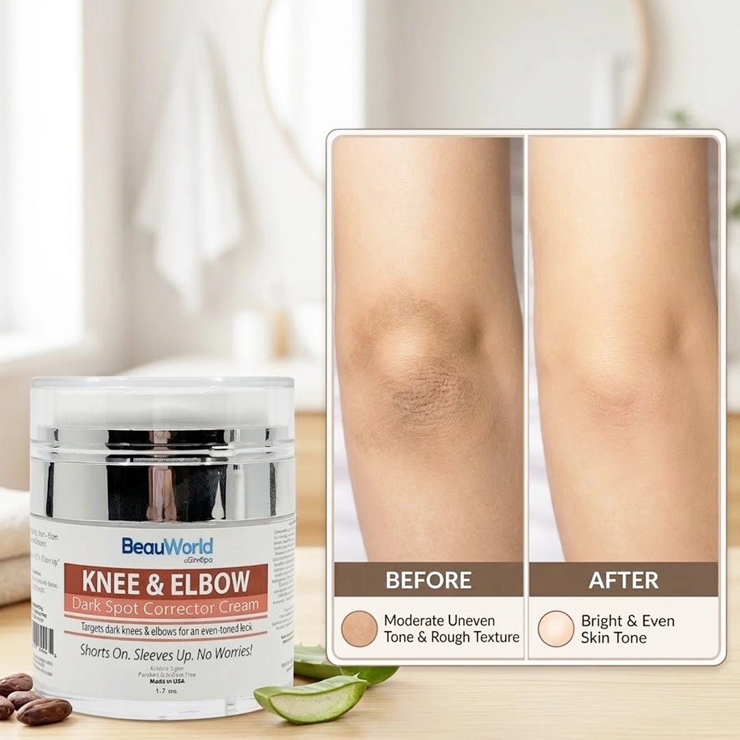 Knees & Elbows Dark Spot Corrector Cream 1.7 oz - SlimSpaOnline
