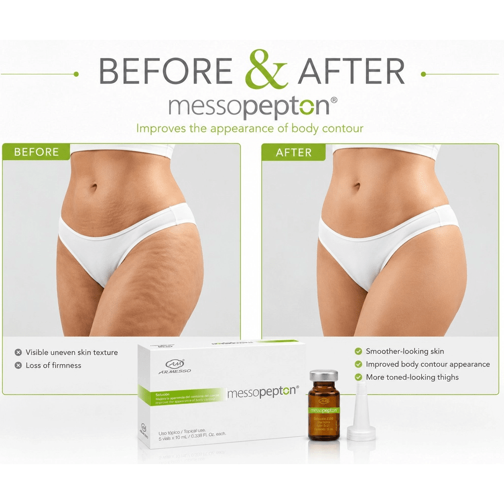 MessoPepton Muscle Growth Vials – Professional Peptide Mesotherapy for Muscle Definition & Contour, 5x10ml (50ml) - SlimSpaOnline
