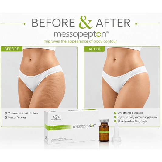 MessoPepton Muscle Growth Vials – Professional Peptide Mesotherapy for Muscle Definition & Contour, 5x10ml (50ml) - SlimSpaOnline