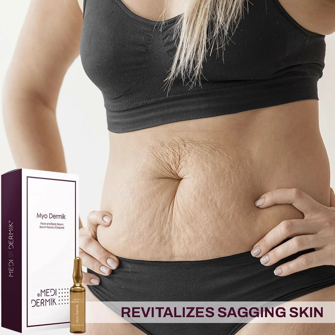 Myo Dermik Ampoules - SlimSpaOnline