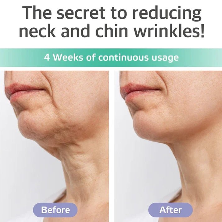 Neck Firming & Double Chin Reducer Cream 8oz - SlimSpaOnline