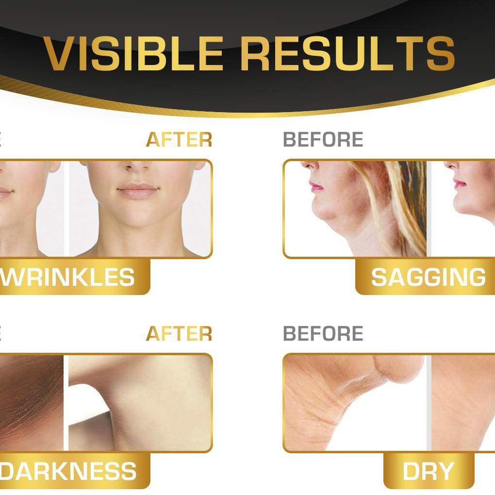 Neck Firming & Double Chin Reducer Cream 8oz - SlimSpaOnline