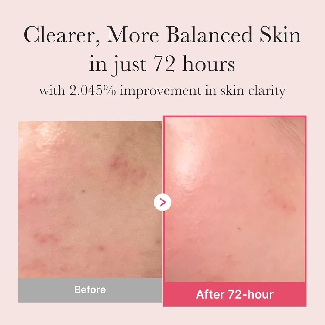 Niacinamide Facial Serum 30 ml. - SlimSpaOnline