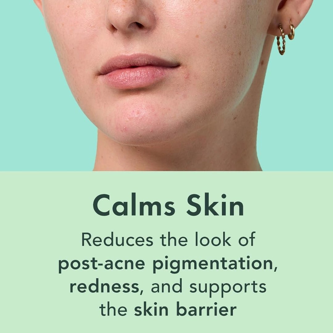 Oil Be Gone Botanical Serum 30 ml. - SlimSpaOnline