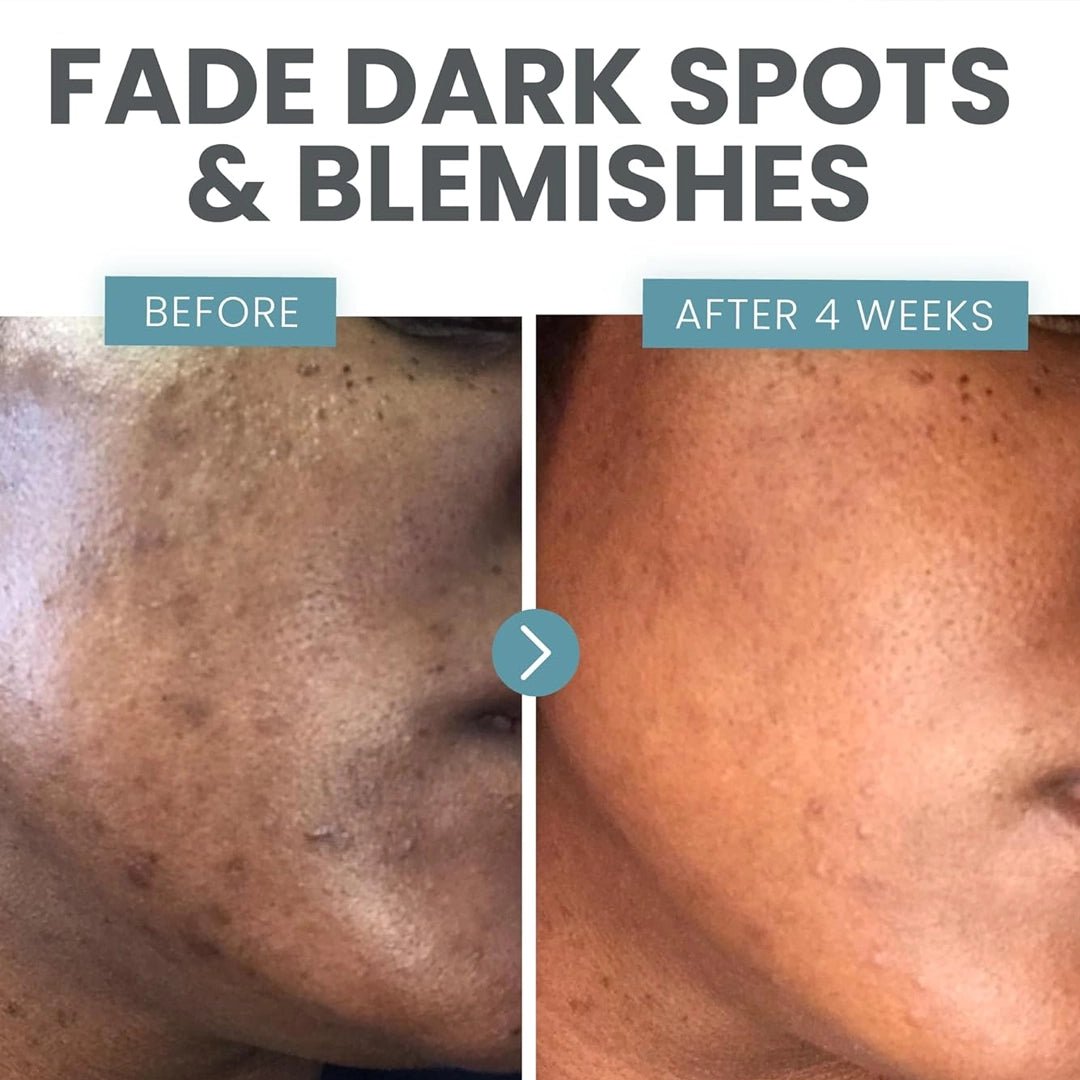 Oil Be Gone Botanical Serum 30 ml. - SlimSpaOnline