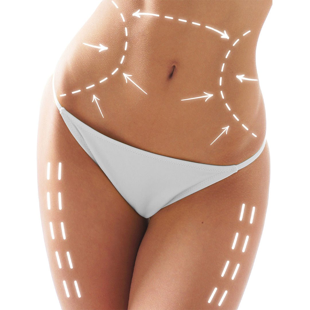 Post Surgery Recovery Body Kit - 12 Treatments | Save $30.44 - SlimSpaOnline