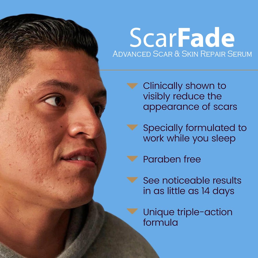ScarFade – Advanced Scar & Skin Repair Serum 8 oz. - SlimSpaOnline