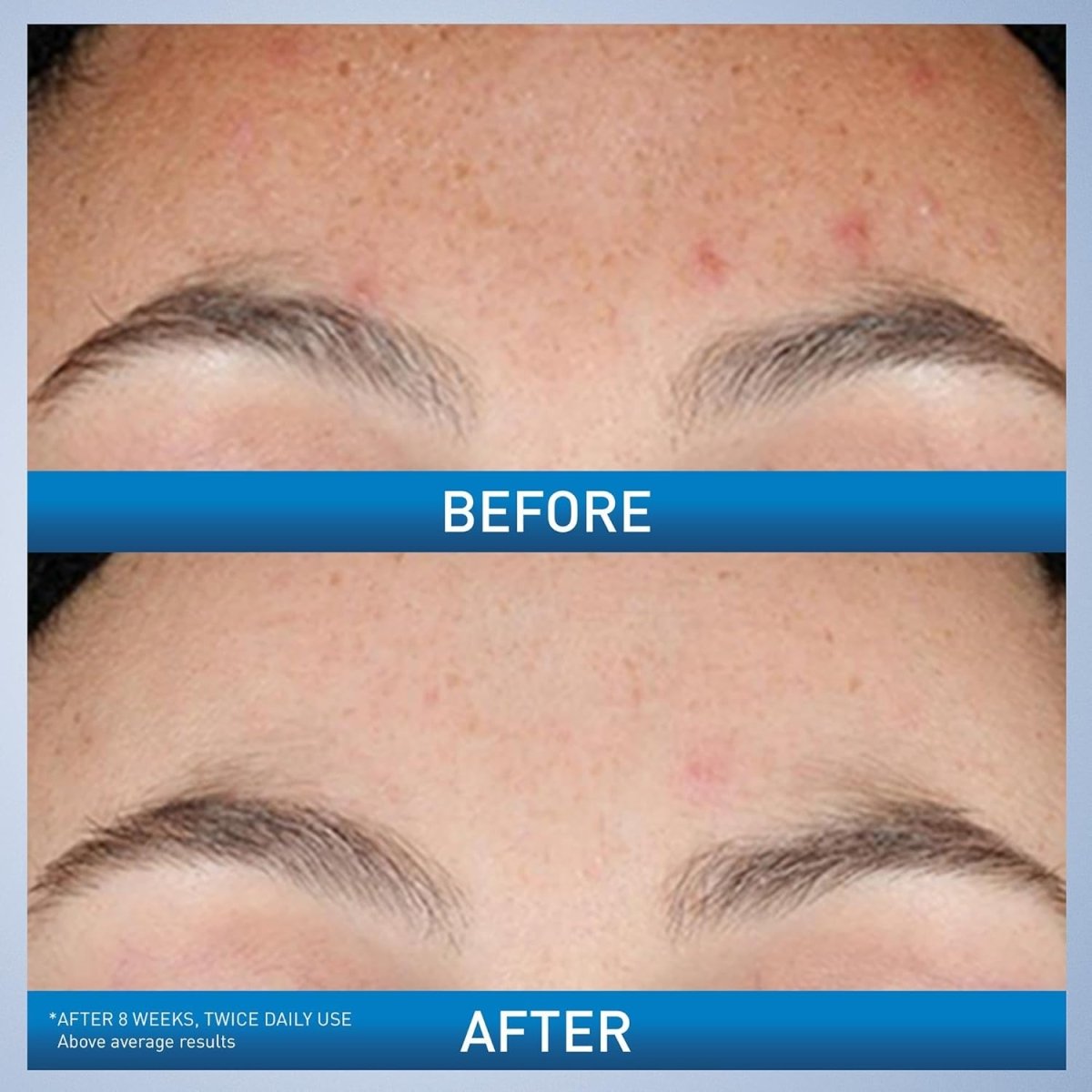 ScarFade – Advanced Scar & Skin Repair Serum 8 oz. - SlimSpaOnline