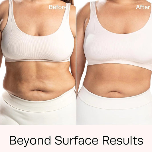 Thermo-Active Hot Gel 8oz skin application — professional heat therapy for fat burning & inch loss treatments | SlimSpa