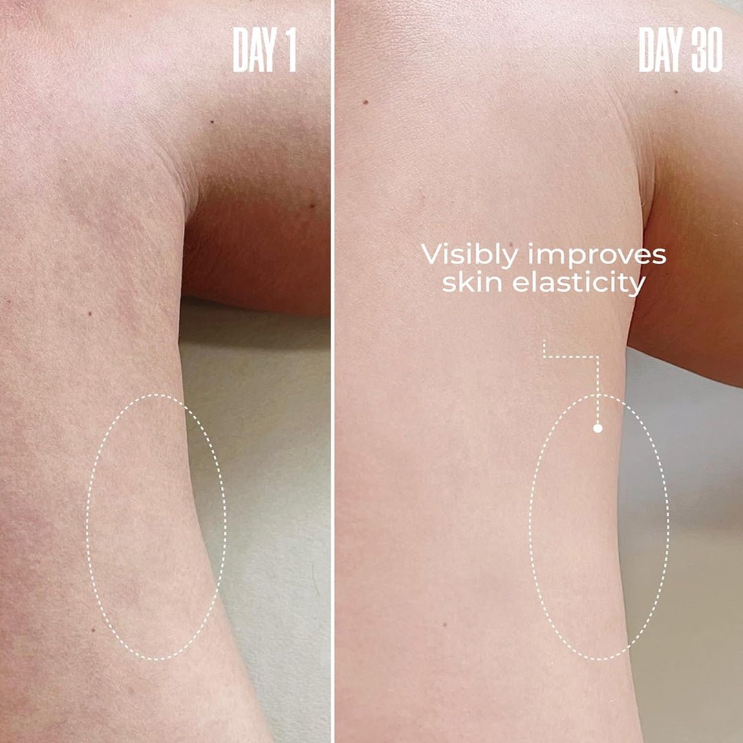 ThighTight™ – Inner Thigh Firming Cream 8 oz. - SlimSpaOnline