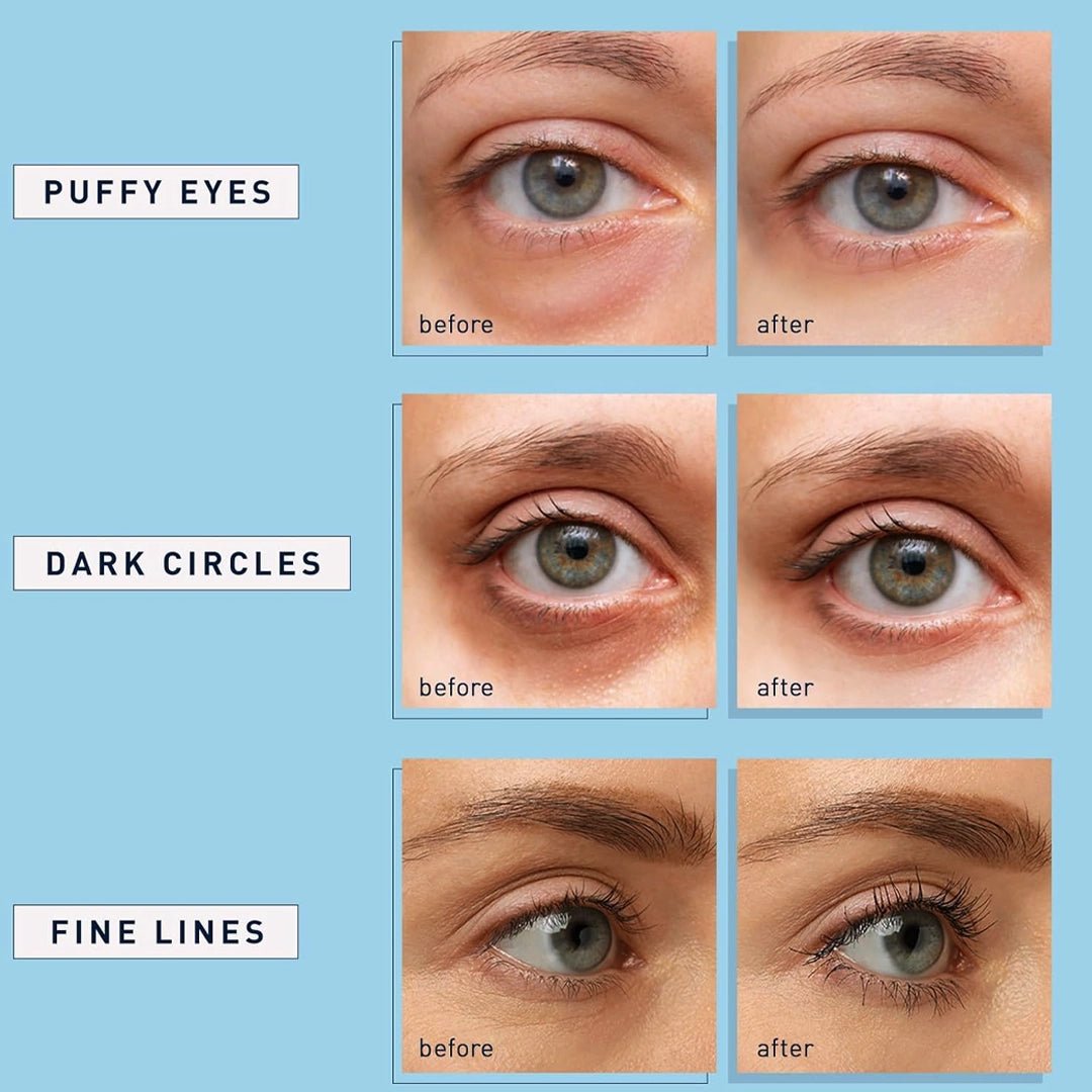 Under - Eye Patch with Escin - Professional Dark Circle & Puffiness Treatment (2 pack) - SlimSpaOnline