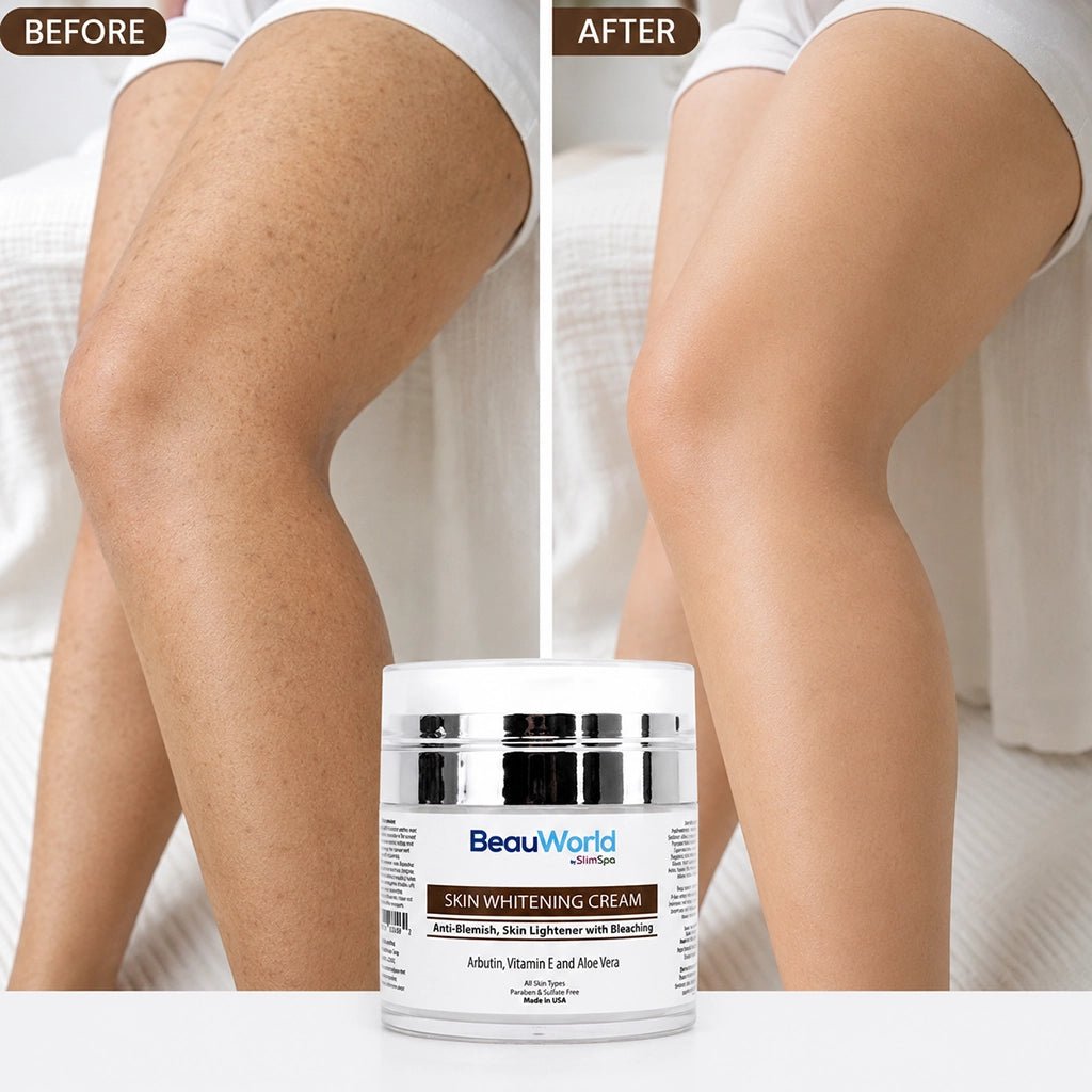 Whitening Blemish Control Cream 50ml – Professional Dark Spot & Hyperpigmentation Treatment - SlimSpaOnline