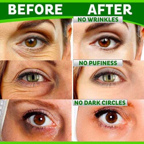 Eye Care Combo (1 Eye Complex Cream 4oz + 1 Dark Circle Eye Cream 4oz)-961
